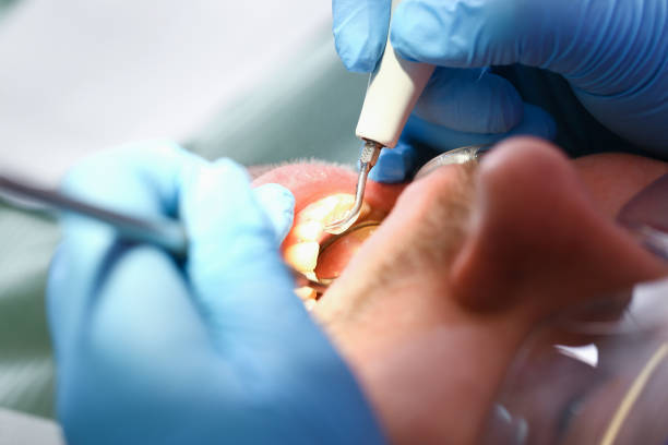 Best Weekend Emergency Dentist in Renovo, PA