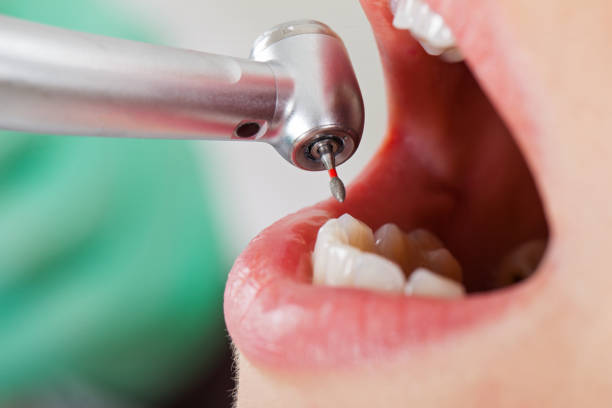 Best Pediatric Emergency Dentist in Renovo, PA